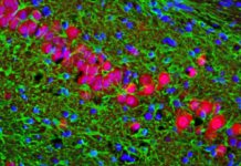 Drug Restores Cells and Memories in Alzheimer’s: Mouse Study