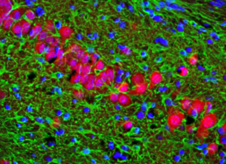 Drug Restores Cells and Memories in Alzheimer’s: Mouse Study