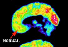 Probing Psychopathic Brains