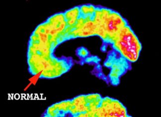 Probing Psychopathic Brains