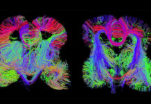 Brain Changes Accompany Development of Metamemory from Childhood to Adolescence