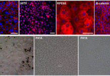 Discovered a new class of mediators or biochemical triggers that he named elovanoids (ELVs)