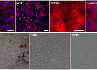 Discovered a new class of mediators or biochemical triggers that he named elovanoids (ELVs)