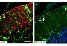 A Molecule for Proper Neural Wiring in the Cerebellum