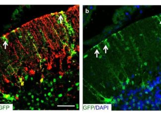 A Molecule for Proper Neural Wiring in the Cerebellum