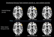 Brain : The Negative Impact of Action Video Games