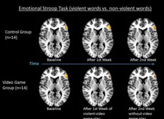 Brain : The Negative Impact of Action Video Games
