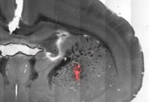 Scientists use magnetic fields to remotely stimulate brain and control body movements
