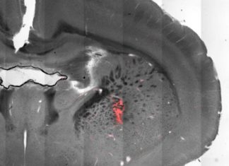 Scientists use magnetic fields to remotely stimulate brain and control body movements