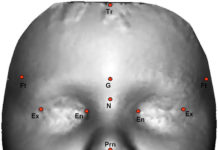 Computer Algorithm Links Facial Masculinity to Autism