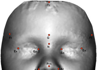 Computer Algorithm Links Facial Masculinity to Autism