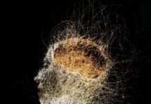 Does Widespread Pain Spread From the Brain ?