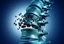 Therapeutic Cocktail Could Restore Motor Skills after Spinal Cord Injury and Stroke