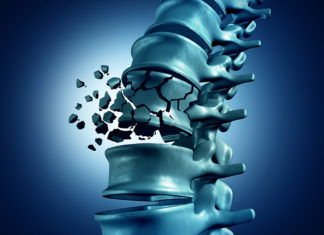 Therapeutic Cocktail Could Restore Motor Skills after Spinal Cord Injury and Stroke