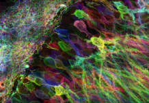 Researchers have developed a robotic system that allows them to focus in on specific neurons in the brain