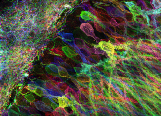 Researchers have developed a robotic system that allows them to focus in on specific neurons in the brain
