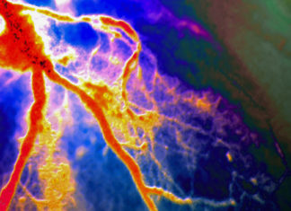 Anti-inflammatory cuts risk of heart attack