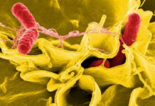 Cholesterol-lowering drugs may fight infectious disease