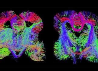 Researchers construct the first circuit map of a brain’s learning and memory center