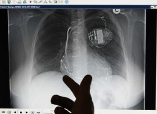 465000 Pacemakers vulnerable – users must visit doctors for fix