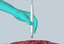 New device accurately identifies cancer in seconds