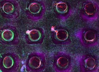3D Bioprinting of Living Tissues