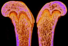 BONE DERIVED HORMONE REVERSES AGE RELATED MEMORY LOSS