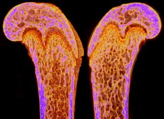 BONE DERIVED HORMONE REVERSES AGE RELATED MEMORY LOSS