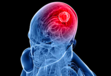 Biologists Identify Possible New Strategy for Halting Brain Tumors