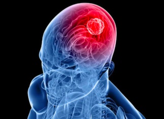 Biologists Identify Possible New Strategy for Halting Brain Tumors