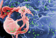 Gut Microbes May Influence Multiple Sclerosis Progression