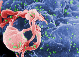 Gut Microbes May Influence Multiple Sclerosis Progression