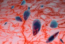 Link Between Toxoplasma Infection and Common Brain Disease