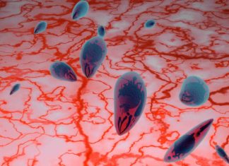 Link Between Toxoplasma Infection and Common Brain Disease