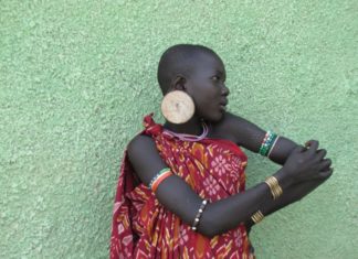 Geneticists has identified new genetic variants associated with skin pigmentation