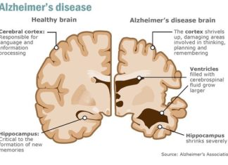 Could Alzheimer’s Be a Disorder of Energy Metabolism?