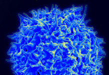 Preventing Autoimmune Disease After Viral Infections