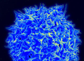 Preventing Autoimmune Disease After Viral Infections