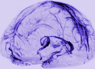 First evidence of the body’s waste system in the human brain discovered