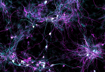 Growing Human Brain Cells in the Lab