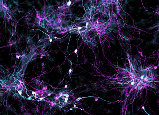 Growing Human Brain Cells in the Lab