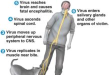 How Rabies Induces Frenzied Behavior