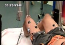 Individual with complete spinal cord injury regains voluntary motor function