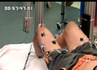 Individual with complete spinal cord injury regains voluntary motor function