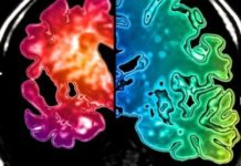 Mechanism Explains How Seizures May Lead to Memory Loss