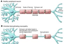 Thin myelin sheaths are sufficient to help restore nervous system impairments in diseases like multiple sclerosis