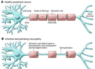 Thin myelin sheaths are sufficient to help restore nervous system impairments in diseases like multiple sclerosis