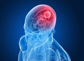 New Approach to Destroying Deadly Brain Tumors