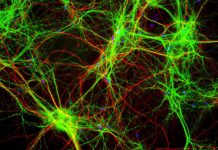 Allen Institute Shares First Open Database of Live Human Brain Cells
