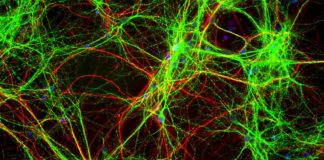 Allen Institute Shares First Open Database of Live Human Brain Cells
